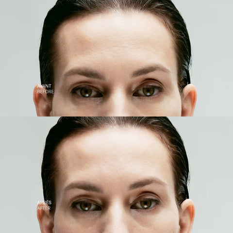 Targeted Skin-Tightening Concentrate